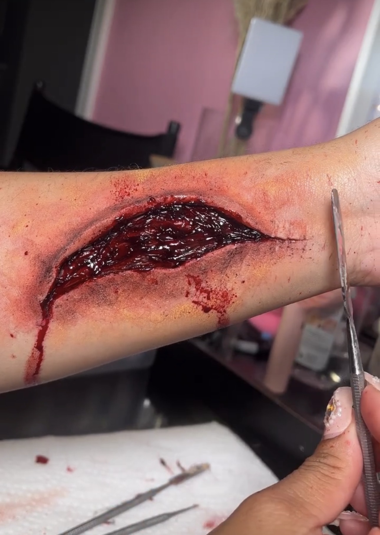 A fresh, deep laceration on a person's arm with bleeding and surrounding redness, held with surgical tools.